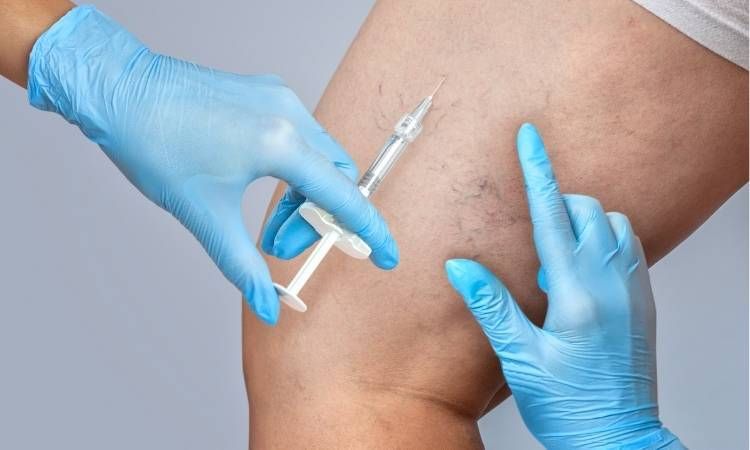 PEIM - Secagem vasinhos